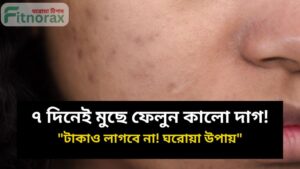 মুখের কালো দাগ দূর করার উপায়