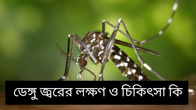 ডেঙ্গু জ্বরের লক্ষণ ও চিকিৎসা কি: সহজ ভাষায় জেনে নিন সবকিছু
